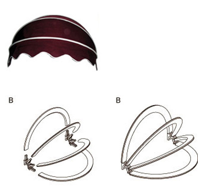 活動(dòng)西瓜篷結(jié)構(gòu)圖